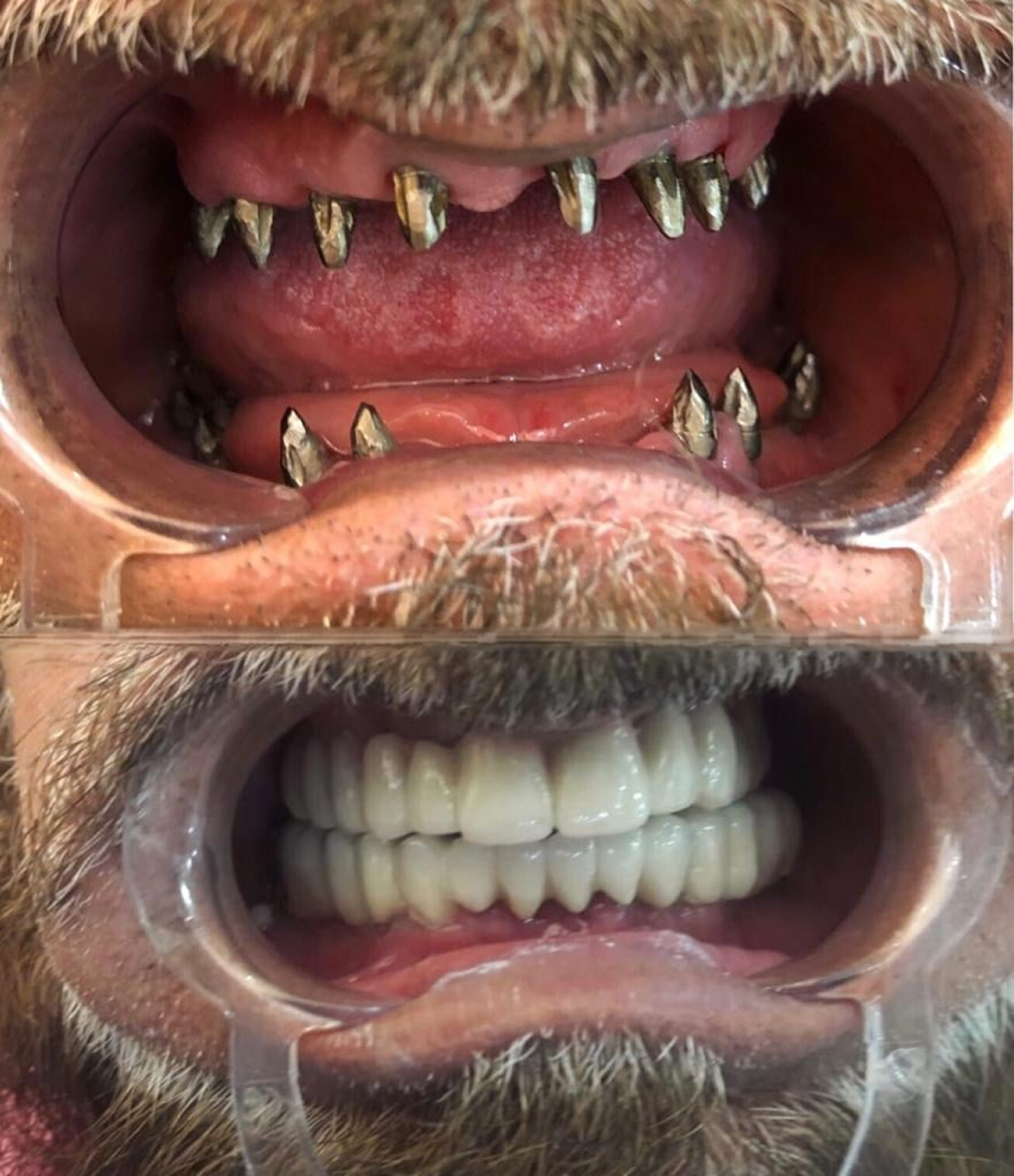 Auto rotating case images.