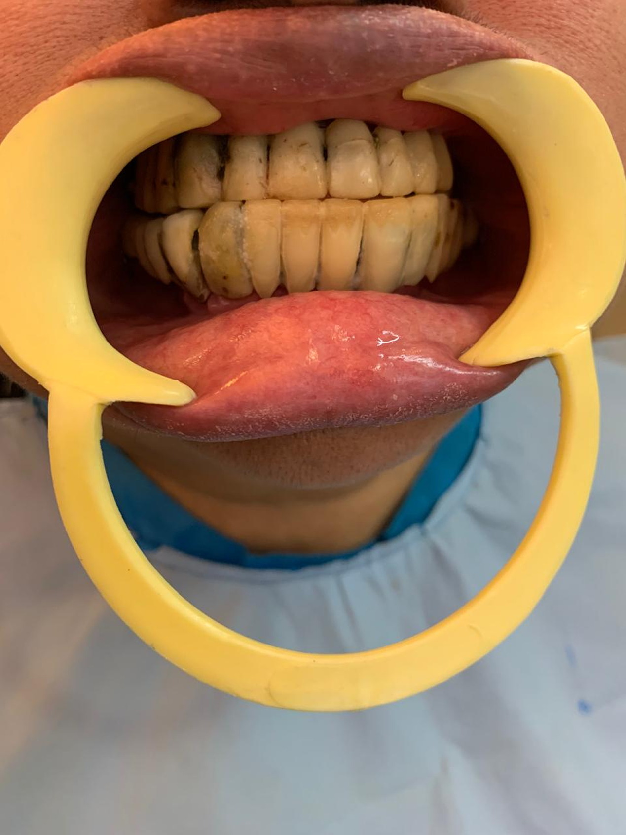 Auto rotating case images.