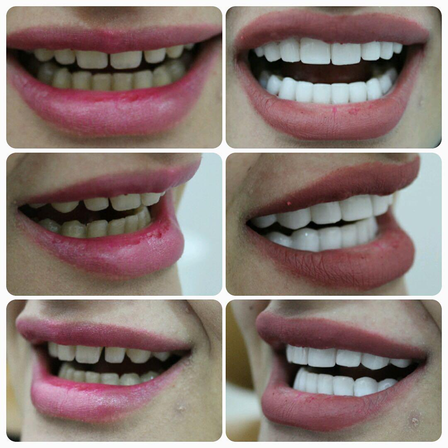 Auto rotating case images.