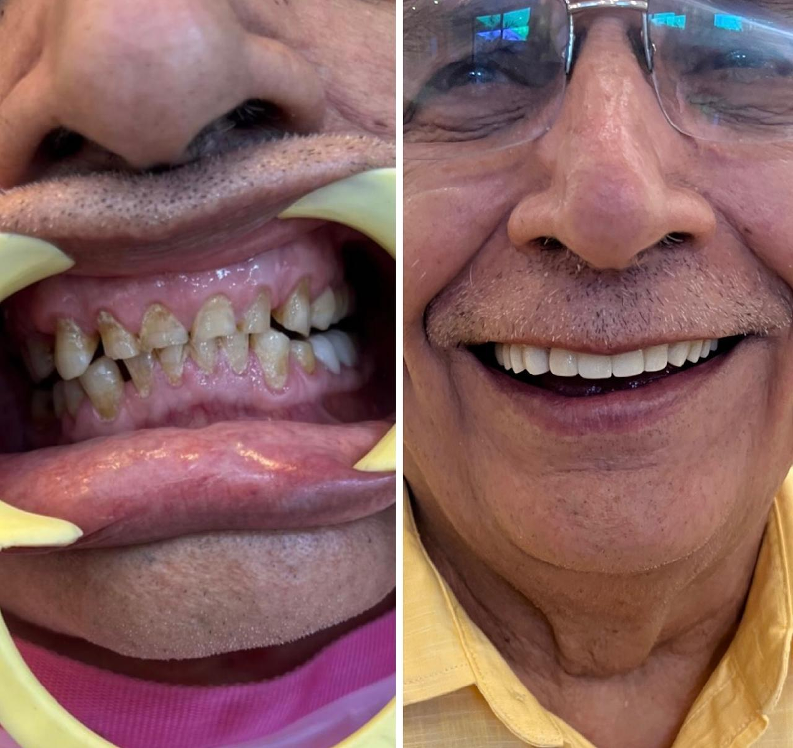 Auto rotating case images.