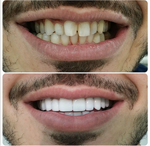 Auto rotating case images.