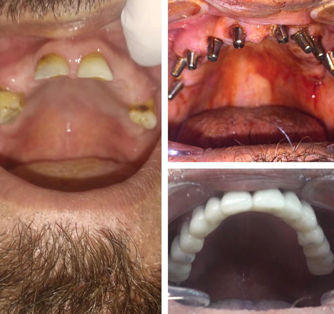 Auto rotating case images.